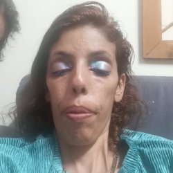 סימה