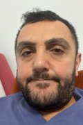 Volkan