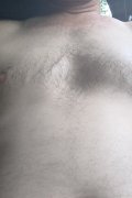 Al