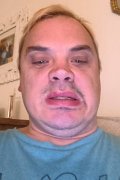 Anthony