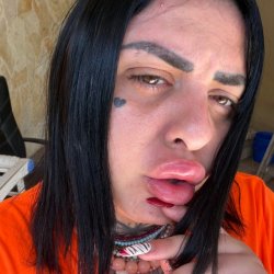 עינב